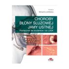 Choroby błony śluzowej
