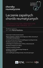 Leczenie zapalnych chorób reumatycznych
