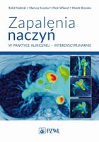 Zapalenia naczyń – w praktyce klinicznej interdyscyplinarnie. Diagnostyka i leczenie