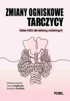 Zmiany ogniskowe tarczycy. Atlas USG dla lekarzy rodzinnych