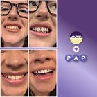 Hello Coco, Whitening Strips, paski wybielające z pap, fioletowe, 14 szt.