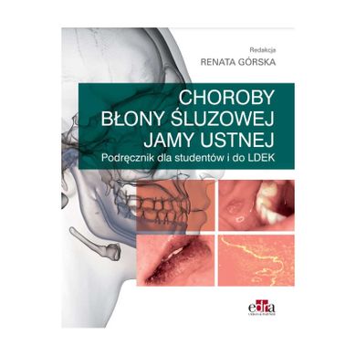 Choroby błony śluzowej