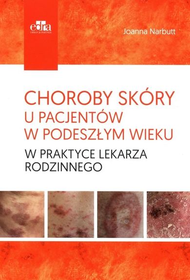 Choroby skóry u pacjentów w podeszłym wieku