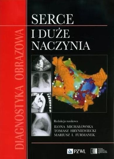 Diagnostyka obrazowa. Serce i duże naczynia