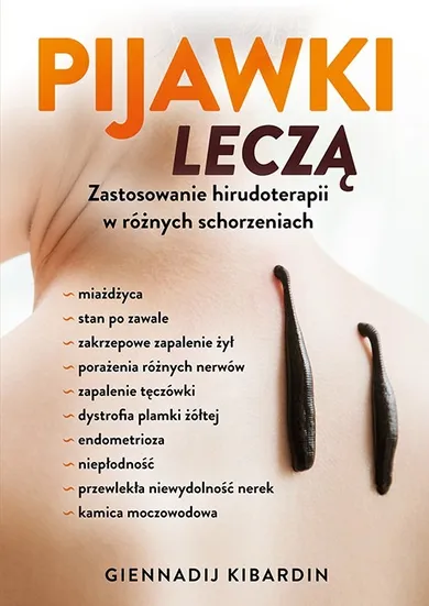 Pijawki leczą. Zastosowanie hirudoterapii w różnych schorzeniach