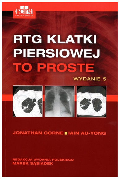 RTG klatki piersiowej