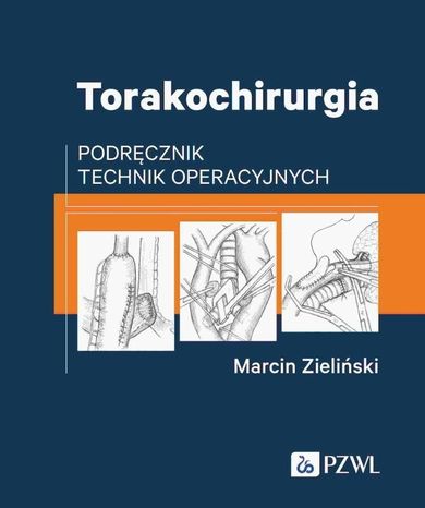Torakochirurgia. Podręcznik technik operacyjnych
