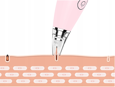 Xiaomi, InFace Electric Blackhead Removal, odkurzacz do wągrów, zaskórników, różowy