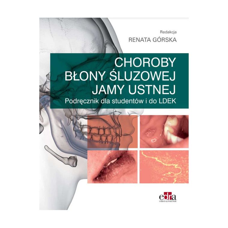 Choroby błony śluzowej