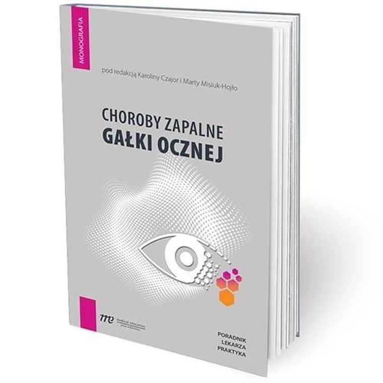 Choroby zapalne gałki ocznej - poradnik lekarza