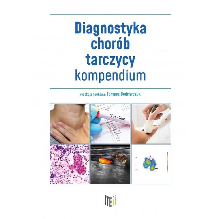 Diagnostyka chorób tarczycy. Kompendium
