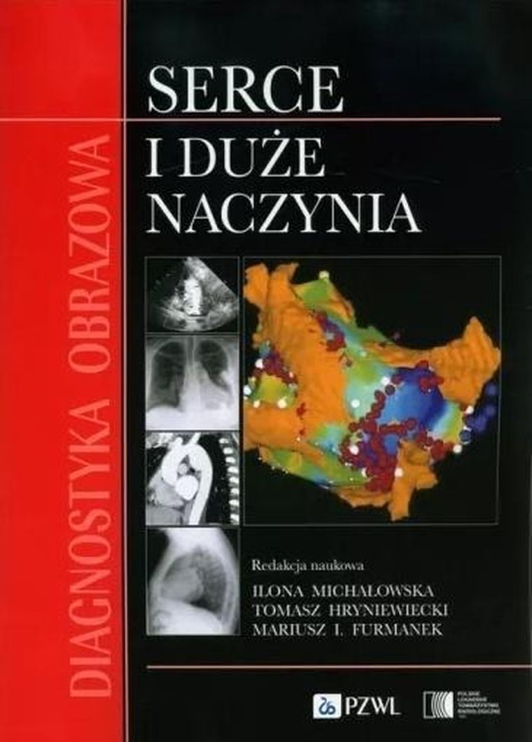 Diagnostyka obrazowa. Serce i duże naczynia