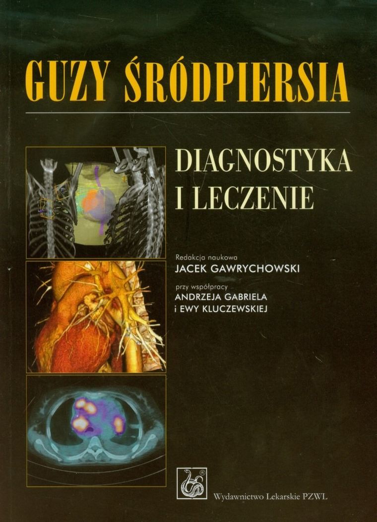 Guzy śródpiersia. Diagnostyka i leczenie