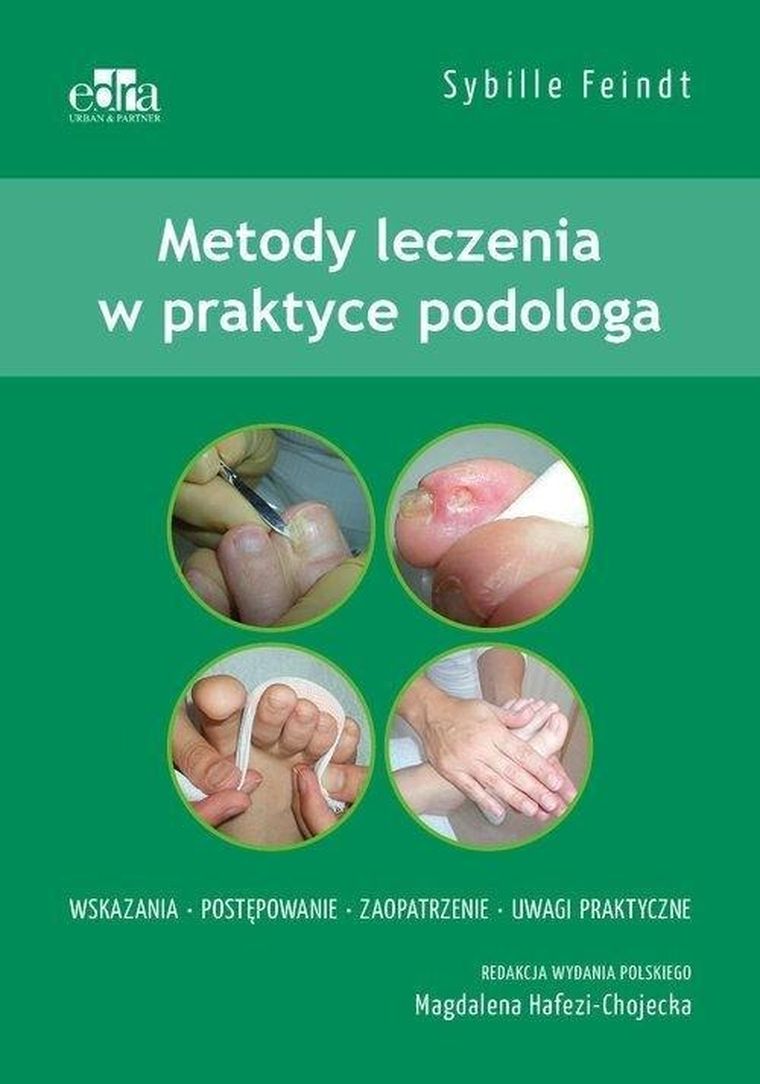 Metody leczenia w podologii