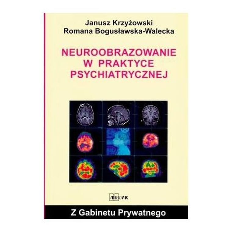 Neuroobrazowanie w praktyce psychiatrycznej