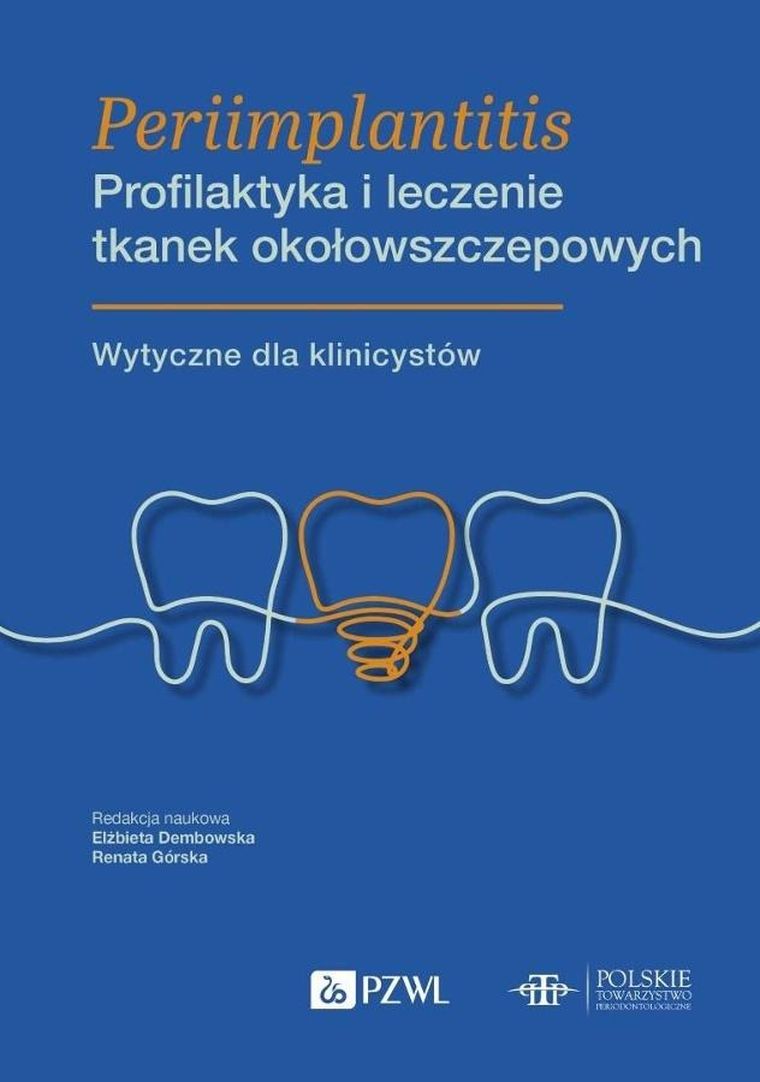 Periimplantitis. Profilaktyka i leczenie tkanek