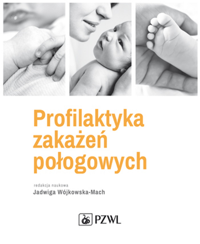 Profilaktyka zakażeń połogowych