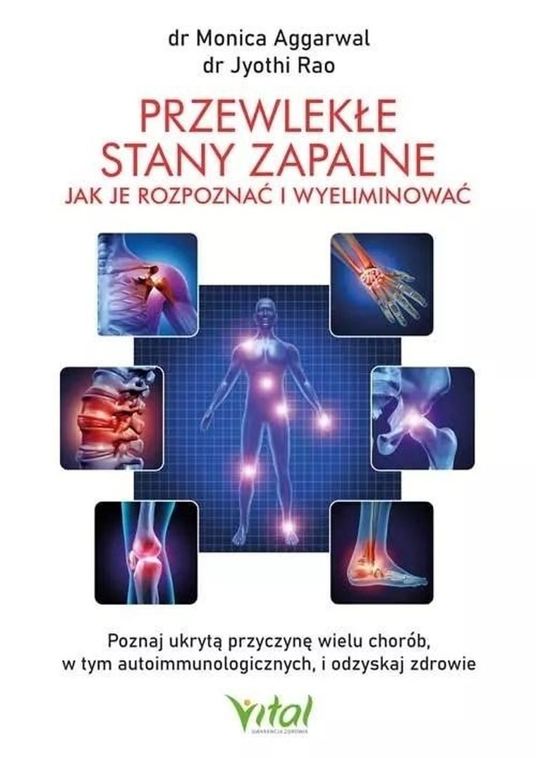 Przewlekłe stany zapalne. Jak je rozpoznać