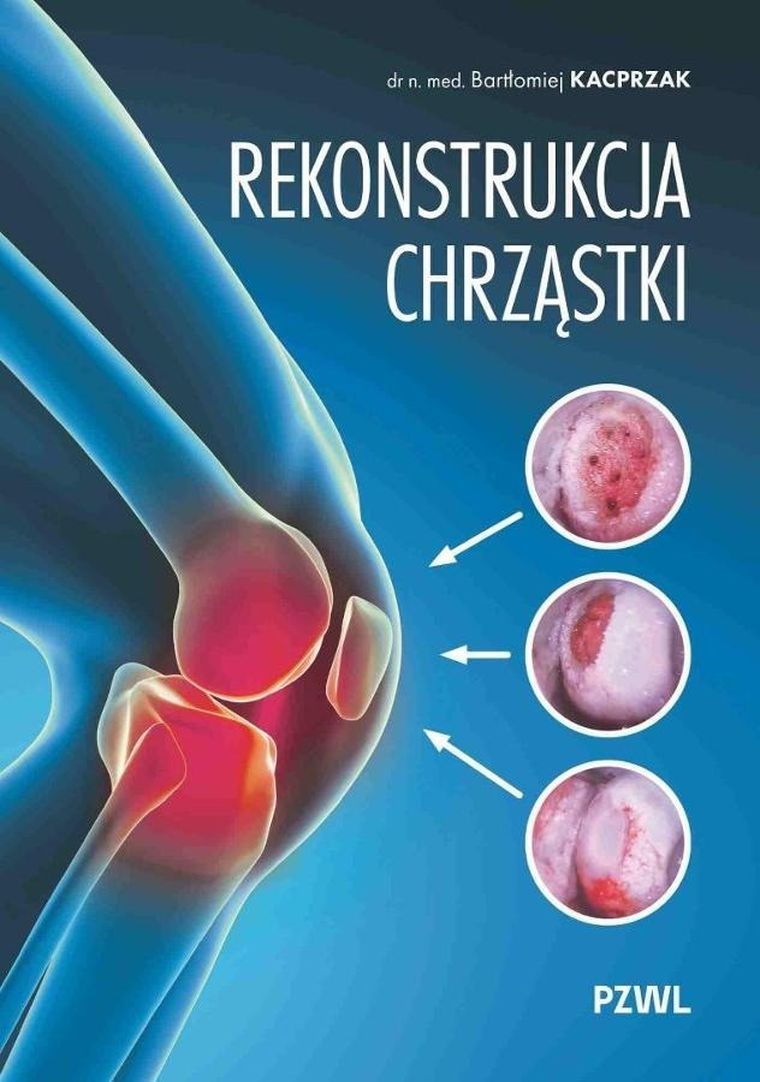 Rekonstrukcja chrząstki