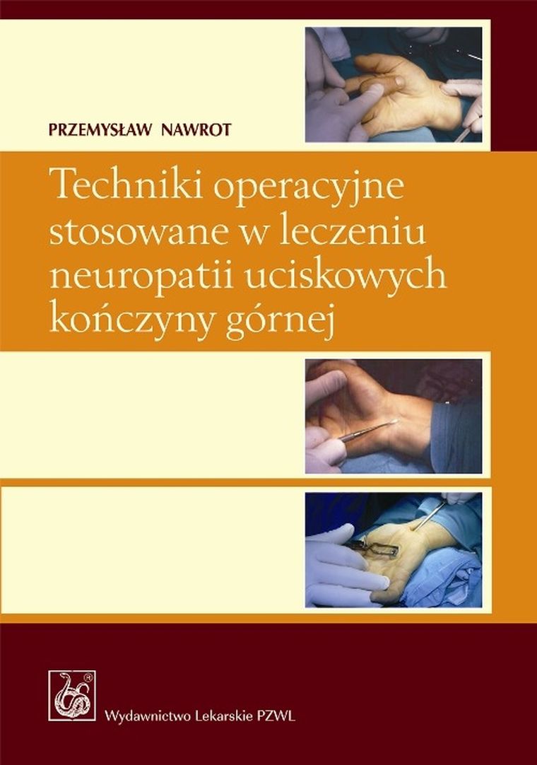 Techniki operacyjne stosowane w leczeniu neuropatii uciskowych kończyny górnej + CD