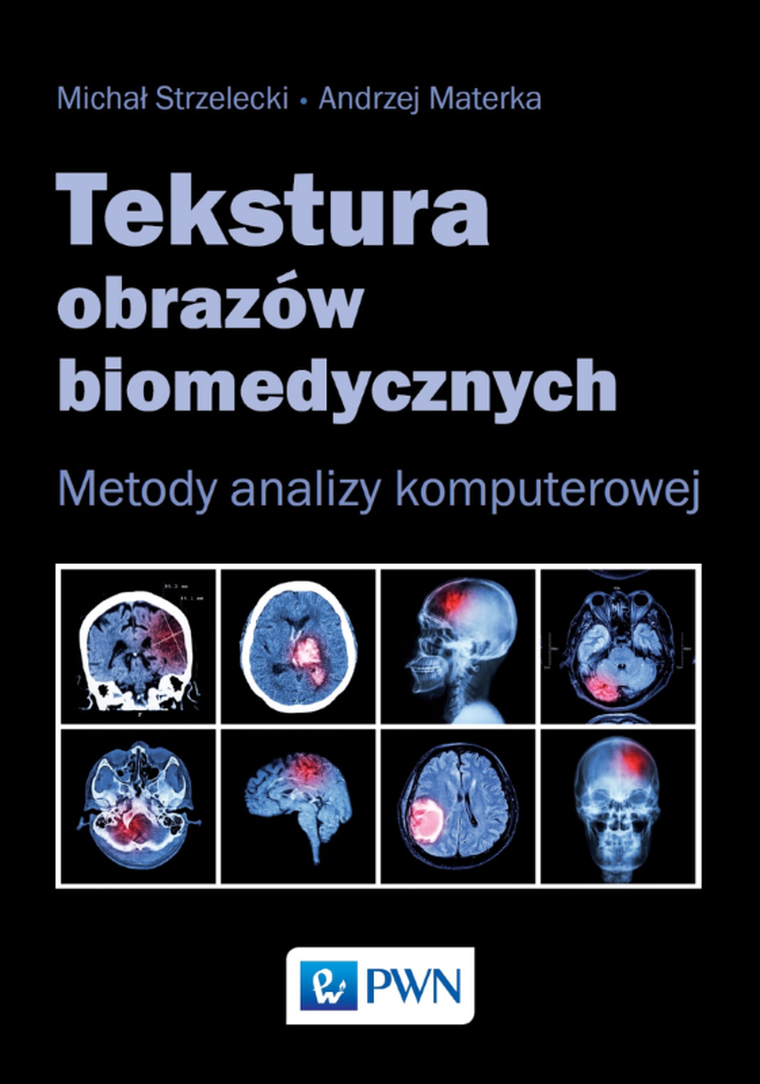 Tekstura obrazów biomedycznych. Metody analizy komputerowej