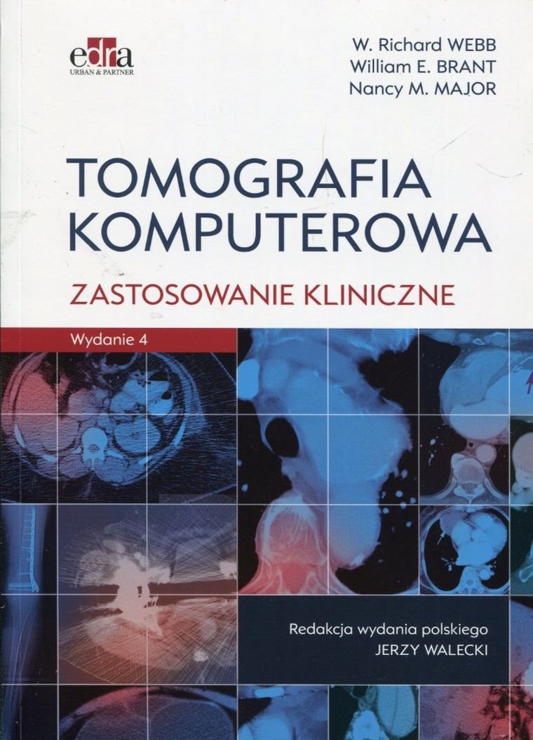 Tomografia komputerowa. Zastosowanie kliniczne