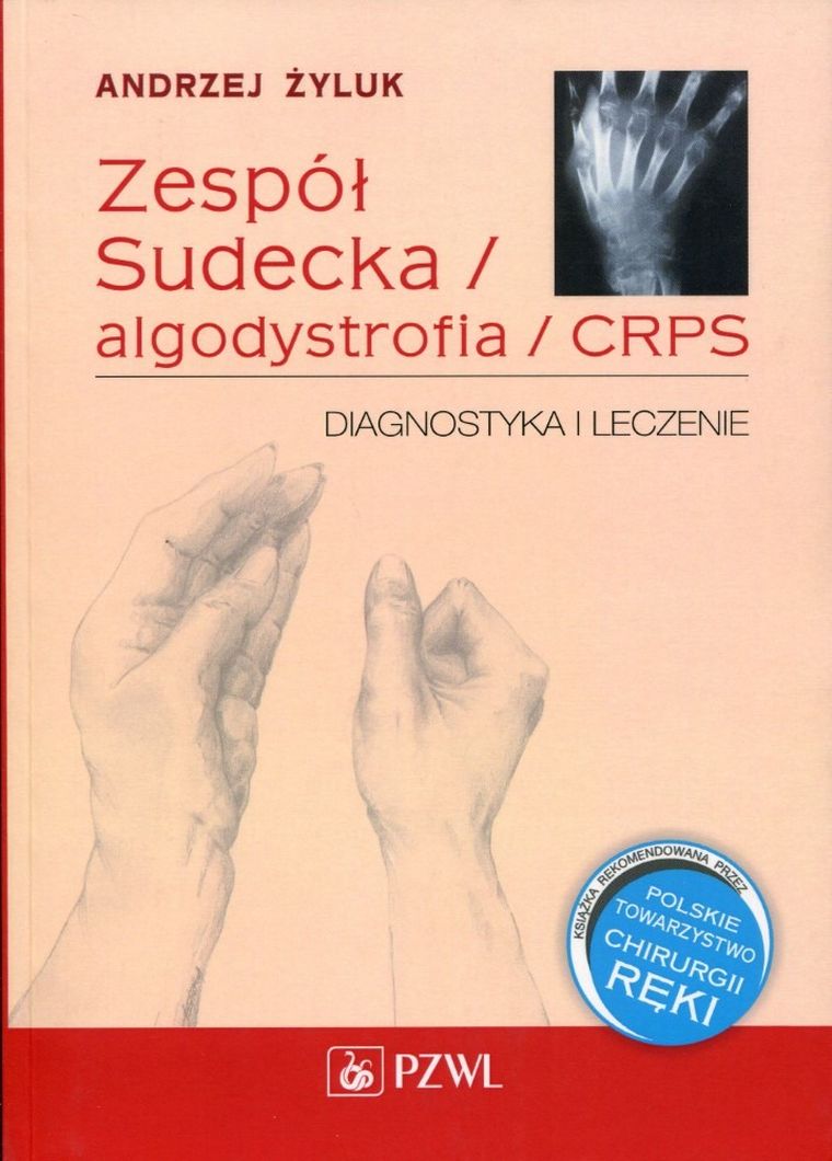 Zespół Sudecka. Algodystrofia. CRPS
