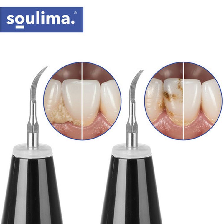 Soulima, skaler ultradzwiękowy do zębów, 25746