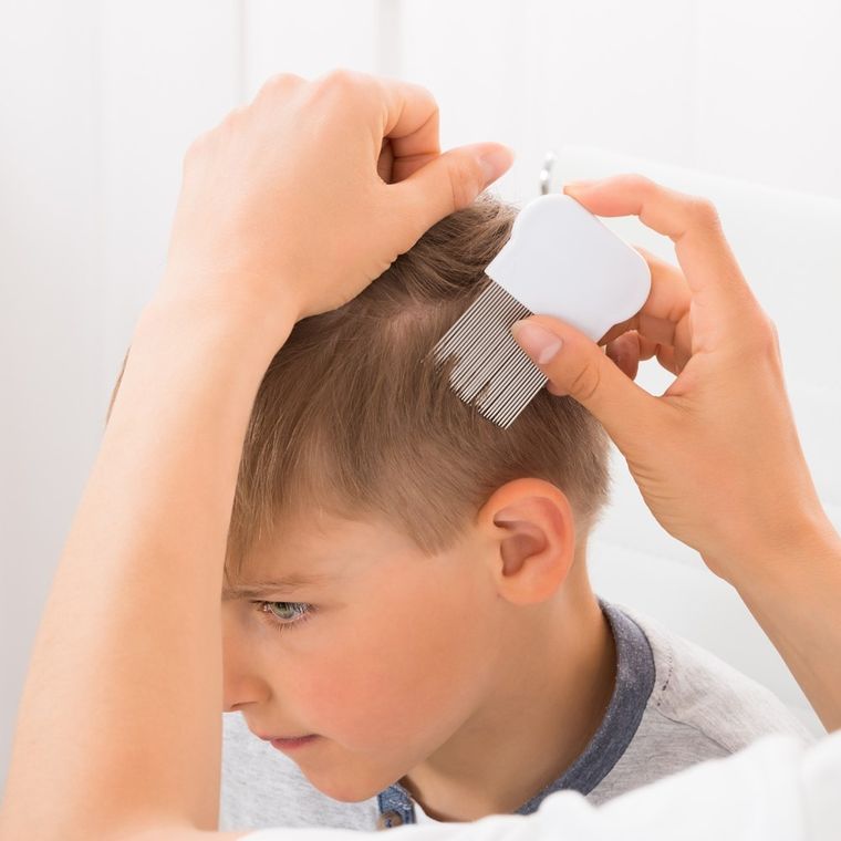 Alphanova Kids, balsam na wszy i ich larwy z olejem kokosowym, 100 ml