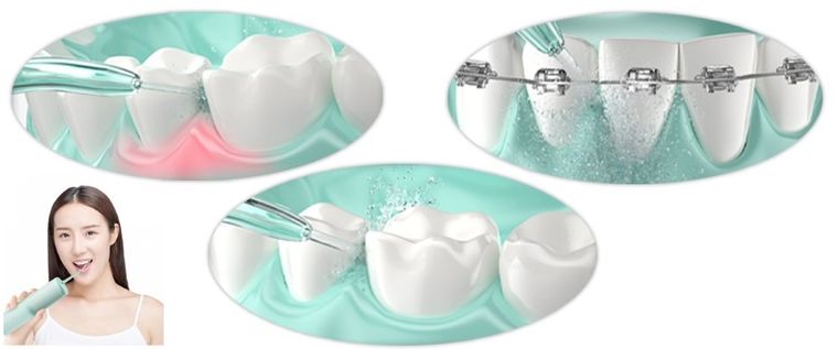 Enchen, irygator podróżny, Mint 3, zielony