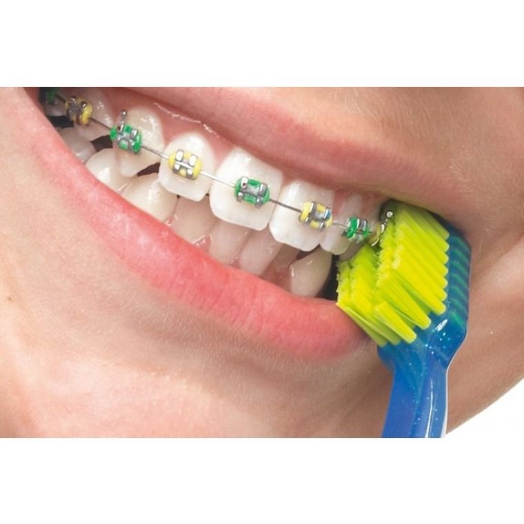 Curaprox, szczoteczka ortodontyczna Compact CS5460, 1 szt.