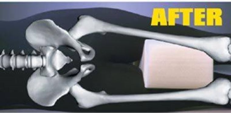 Relax, poduszka na zmęczone nogi, bolące stawy i kręgosłup