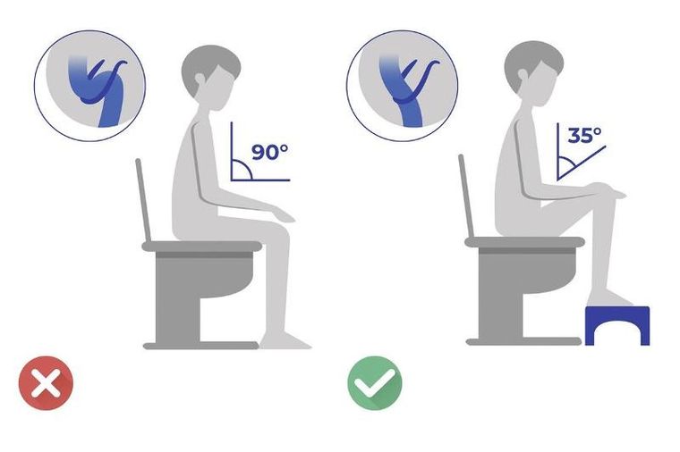 Maximex, podnóżek do toalety, plastikowy