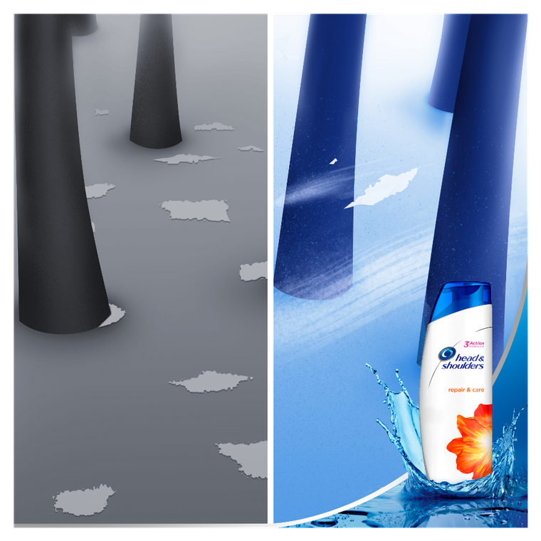 Head & Shoulders, Anti-Hairfall, szampon przeciwłupieżowy dla kobiet 400 ml